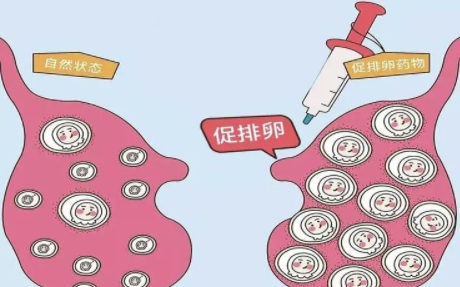 卵巢早衰是不是只能用抗洁挤方案，这种方案成功率高吗