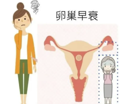 年纪轻轻就有卵巢早衰还能够生育吗，为什么这么年轻就有卵巢早衰了