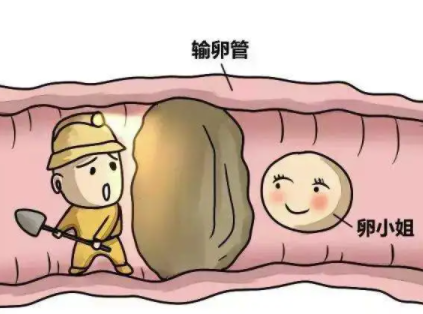 输卵管性不孕试管成功率高吗，生出来的孩子会遗传不孕吗