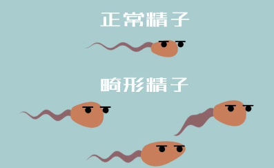 异常形态精子98怎么办,精子异常率多少为正常