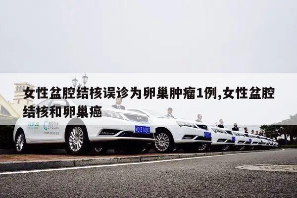 女性盆腔结核误诊为卵巢肿瘤1例,女性盆腔结核和卵巢癌