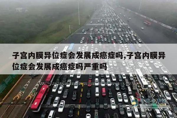 子宫内膜异位症会发展成癌症吗,子宫内膜异位症会发展成癌症吗严重吗