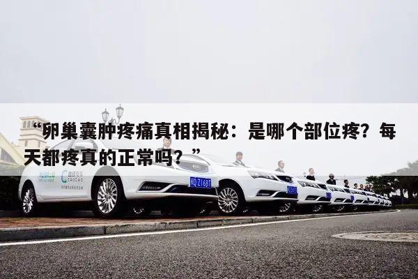 “卵巢囊肿疼痛真相揭秘:是哪个部位疼?每天都疼真的正常吗?”