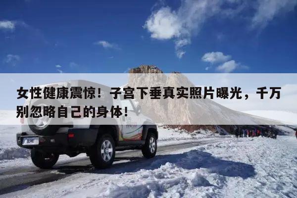 女性健康震惊!子宫下垂真实照片曝光,千万别忽略自己的身体!