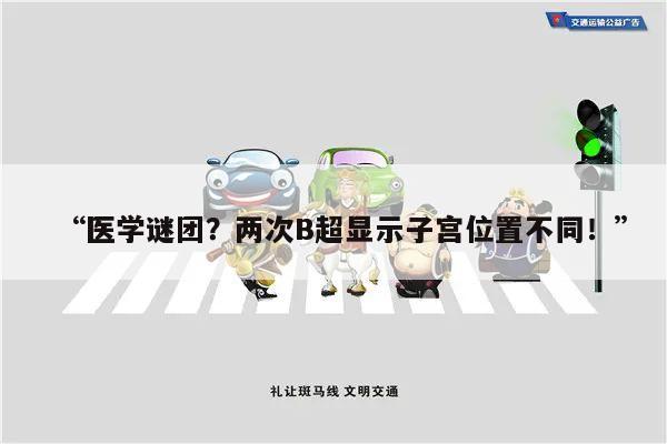 “医学谜团？两次B超显示子宫位置不同！”