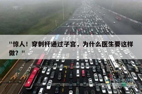 "惊人!穿刺杆通过子宫,为什么医生要这样做?"