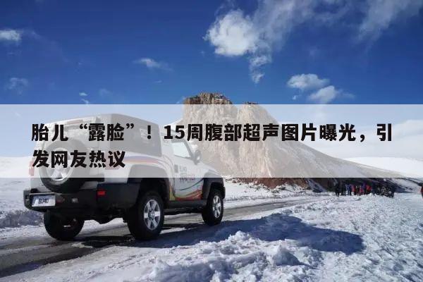 胎儿“露脸”!15周腹部超声图片曝光,引发网友热议