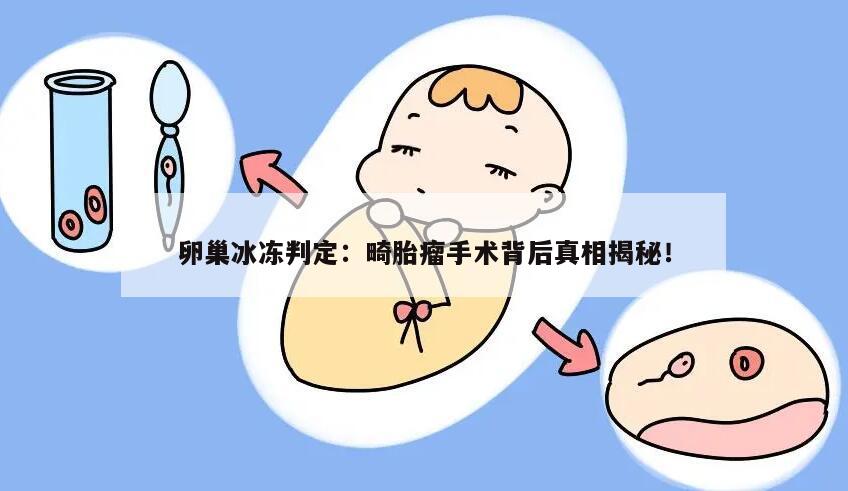 卵巢冰冻判定：畸胎瘤手术背后真相揭秘！