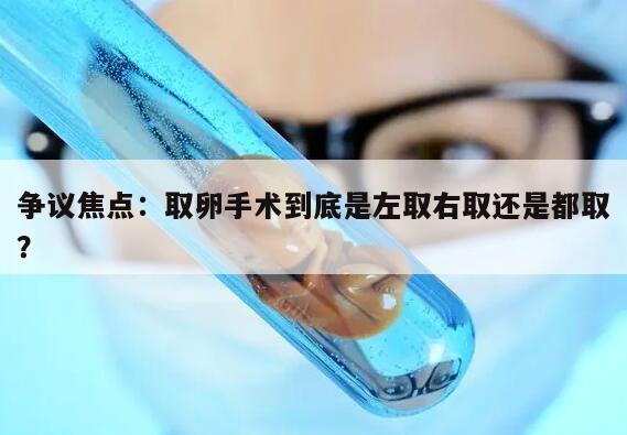 争议焦点：取卵手术到底是左取右取还是都取？