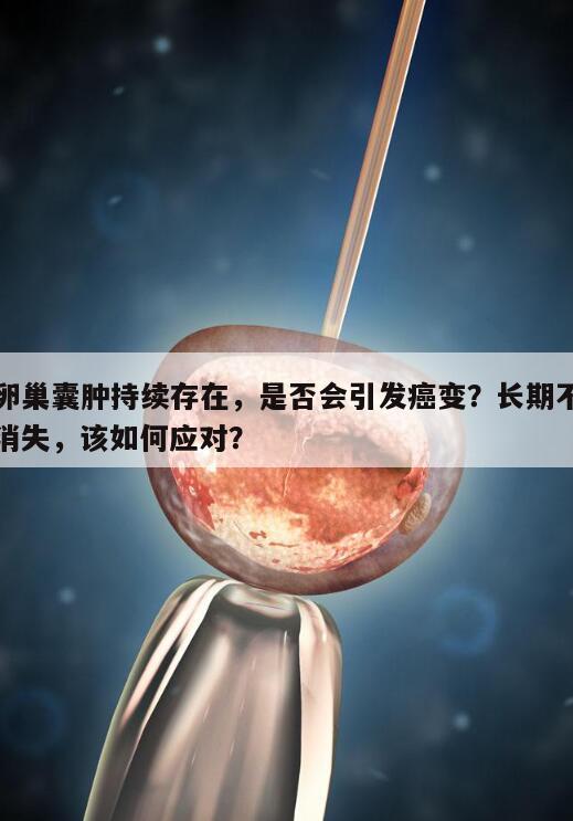 卵巢囊肿持续存在,是否会引发癌变?