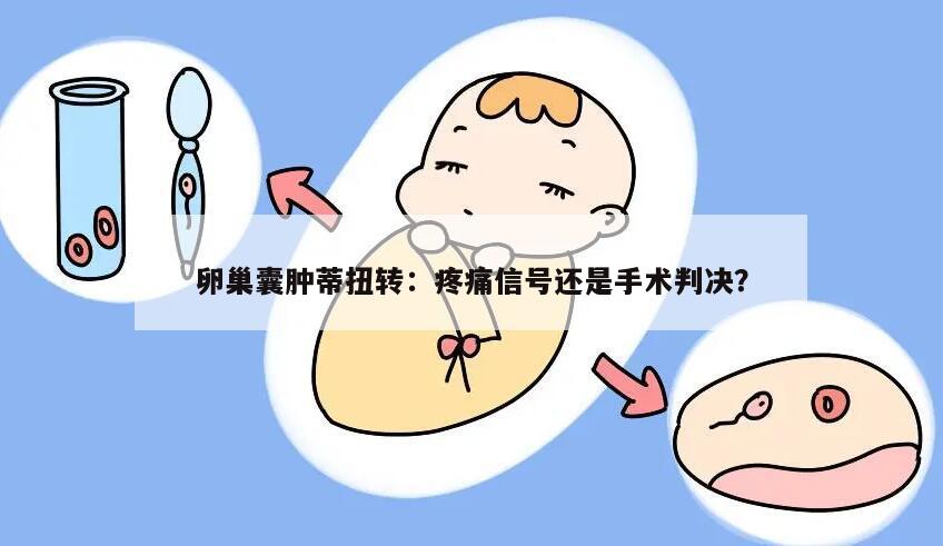 卵巢囊肿蒂扭转：疼痛信号还是手术判决？
