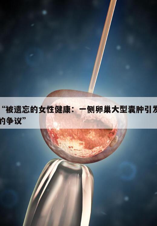 “被遗忘的女性健康:一侧卵巢大型囊肿引发的争议”