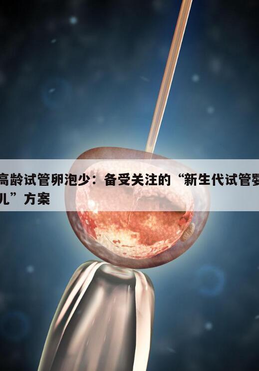 高龄试管卵泡少：备受关注的“新生代试管婴儿”方案