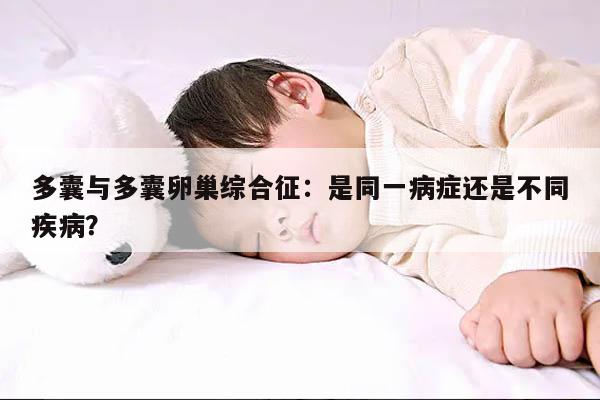 多囊与多囊卵巢综合征:是同一病症还是不同疾病?