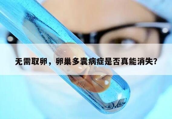 取卵后卵巢多囊病症是否会消失?