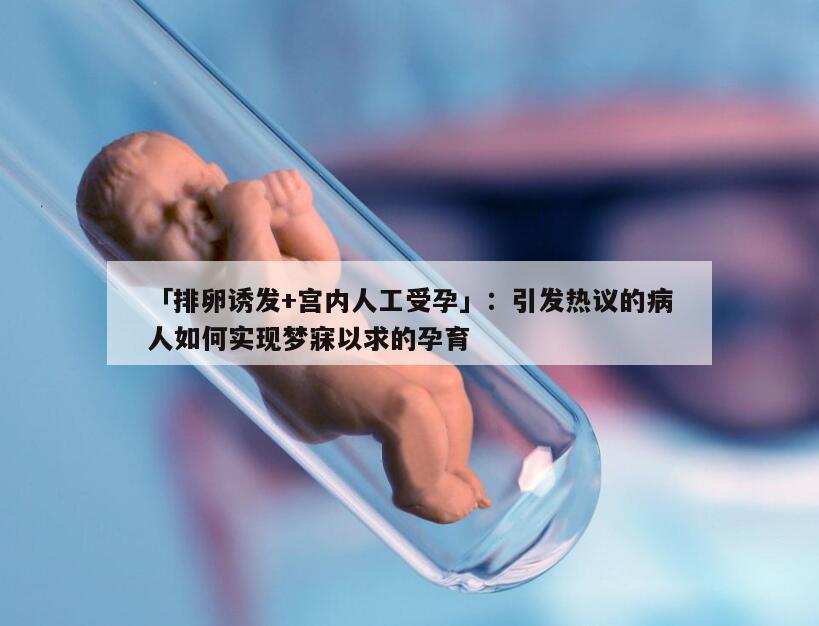 促排卵加宫腔内人工授精的优势