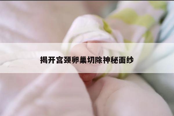 揭开宫颈卵巢切除神秘面纱