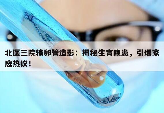 北医三院输卵管造影流程