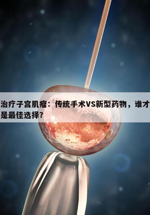 治疗子宫肌瘤：传统手术VS新型药物，谁才是最佳选择？