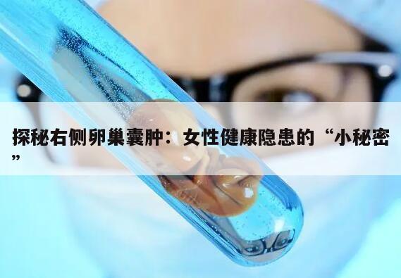 探秘右侧卵巢囊肿:女性健康隐患的“小秘密”