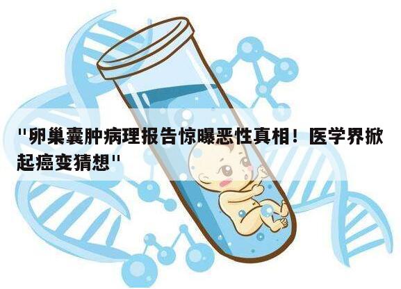 卵巢囊肿病理报告惊曝恶性真相！医学界掀起癌变猜想