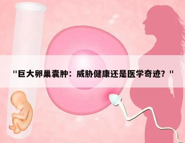 巨大卵巢囊肿：威胁健康还是医学奇迹？