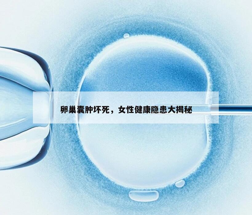 卵巢囊肿坏死，女性健康隐患大揭秘