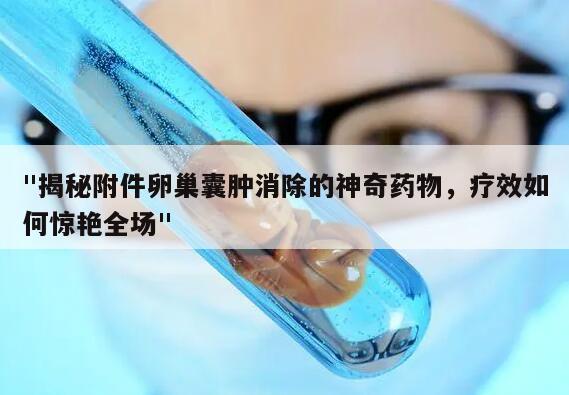 揭秘附件卵巢囊肿消除的神奇药物,疗效如何惊艳全场