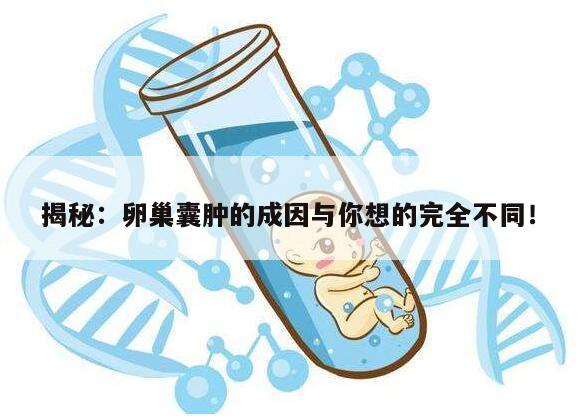 揭秘:卵巢囊肿的成因与你想的完全不同!