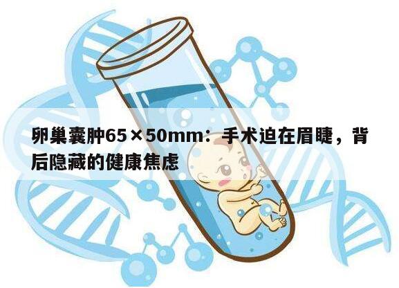 卵巢囊肿65×50mm:手术的必要性和注意事项