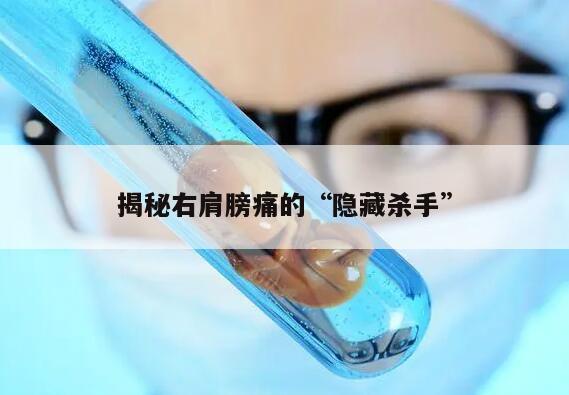 揭秘右肩膀痛的“隐藏杀手”