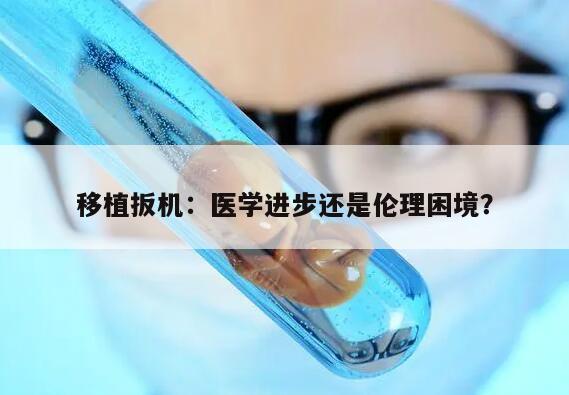 移植扳机：医学进步还是伦理困境？