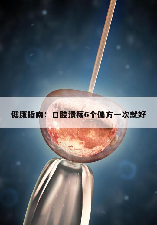 健康指南:口腔溃疡6个偏方一次就好
