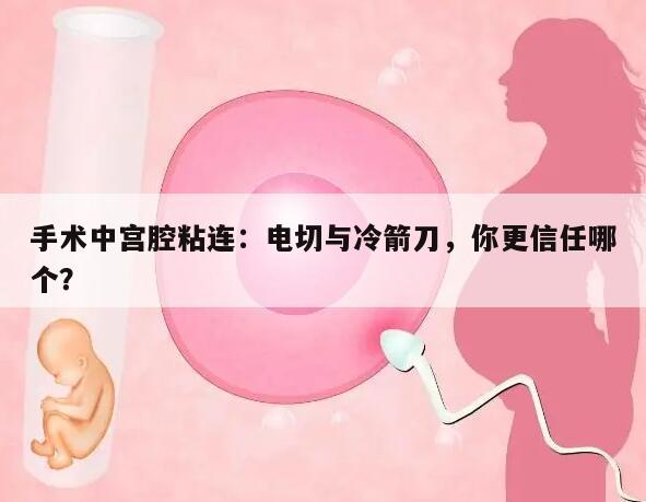宫腔粘连手术中的电切与冷箭刀:哪个更好?