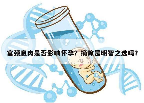 宫颈息肉是否影响怀孕?摘除是明智之选吗?