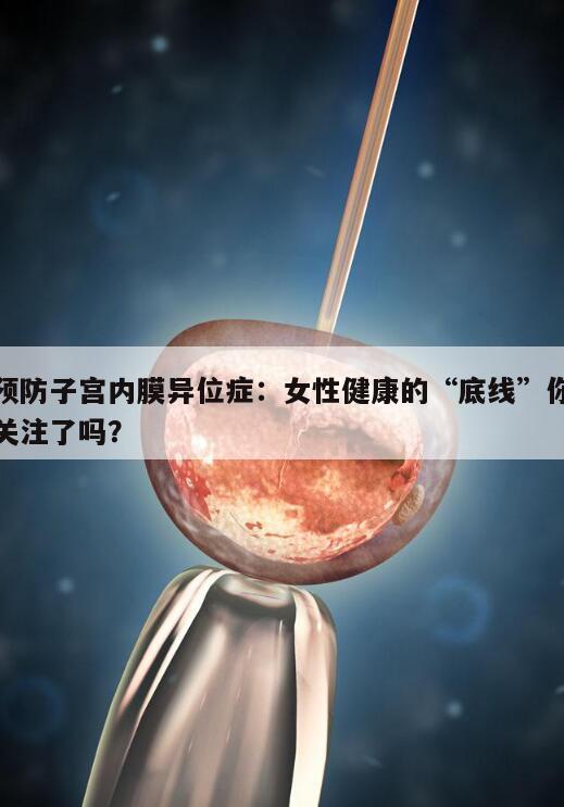 预防子宫内膜异位症:女性健康的“底线”你关注了吗?