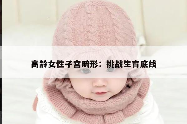 高龄女性子宫畸形：挑战生育底线