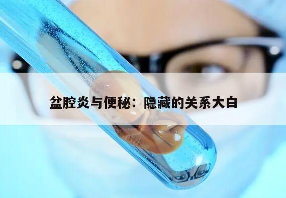 盆腔炎与便秘:隐藏的关系大白