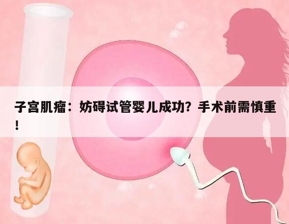 子宫肌瘤:妨碍试管婴儿成功?手术前需慎重!