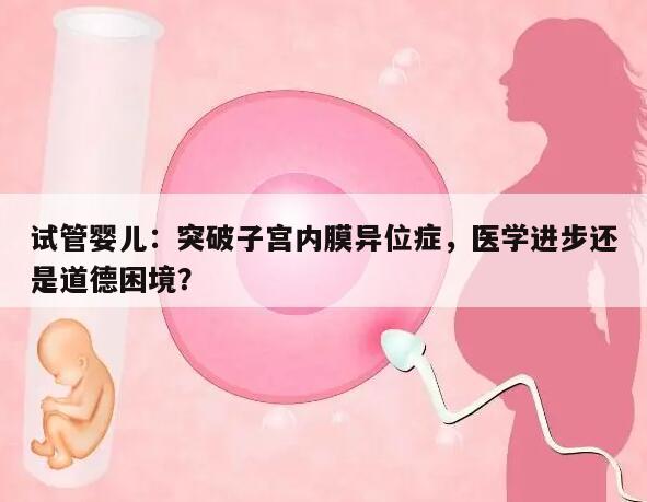 试管婴儿:突破子宫内膜异位症,医学进步还是道德困境?