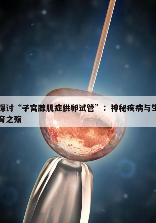 探讨“子宫腺肌症供卵试管”：神秘疾病与生育之殇
