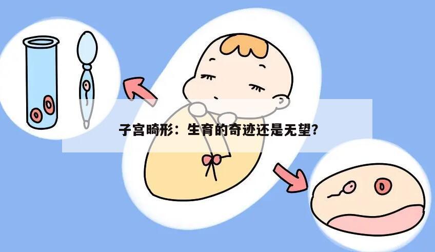 子宫畸形：生育的奇迹还是无望？