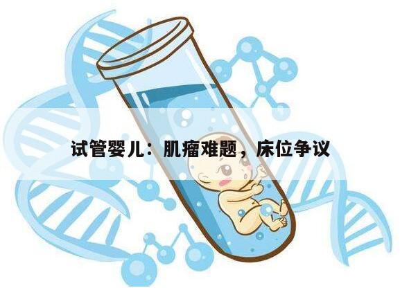 试管婴儿:肌瘤难题,床位争议