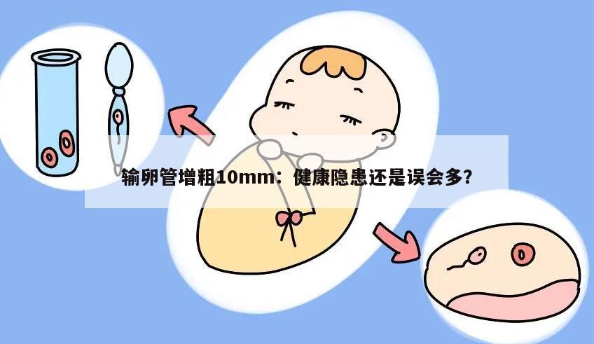 输卵管增粗10mm:健康隐患还是误会多?