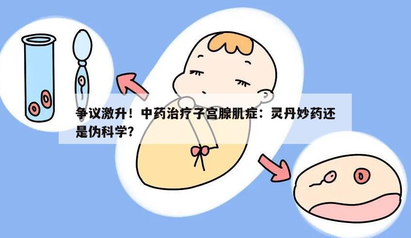 争议激升！中药治疗子宫腺肌症：灵丹妙药还是伪科学？