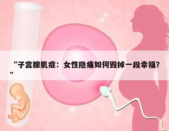 子宫腺肌症:女性隐痛如何毁掉一段幸福?