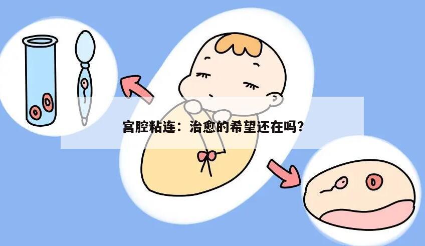 宫腔粘连：治愈的希望还在吗？