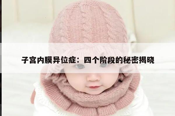 子宫内膜异位症:四个阶段的秘密揭晓