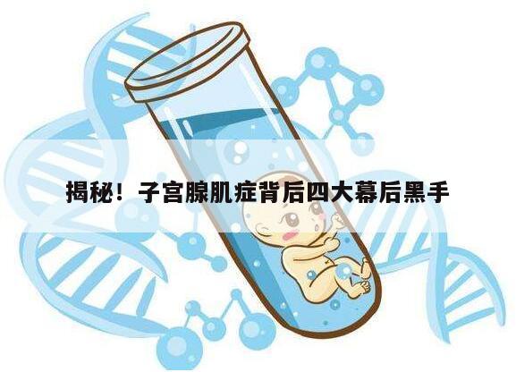 揭秘!子宫腺肌症背后四大幕后黑手