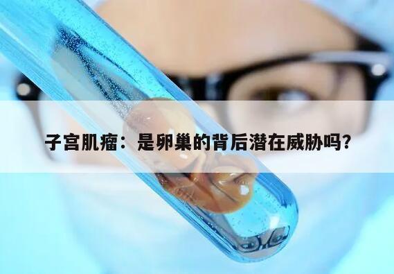 子宫肌瘤:是卵巢的背后潜在威胁吗?